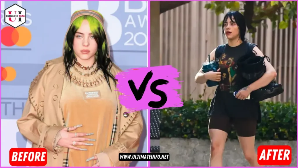 Billie Eilish Weight 
Loss Before and After Picture